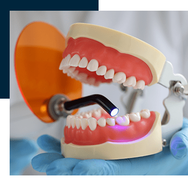 Dental Bonding Mims FL