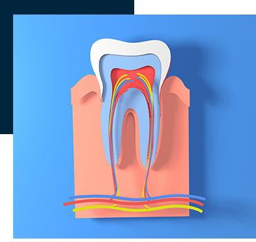 Root Canals Mims FL